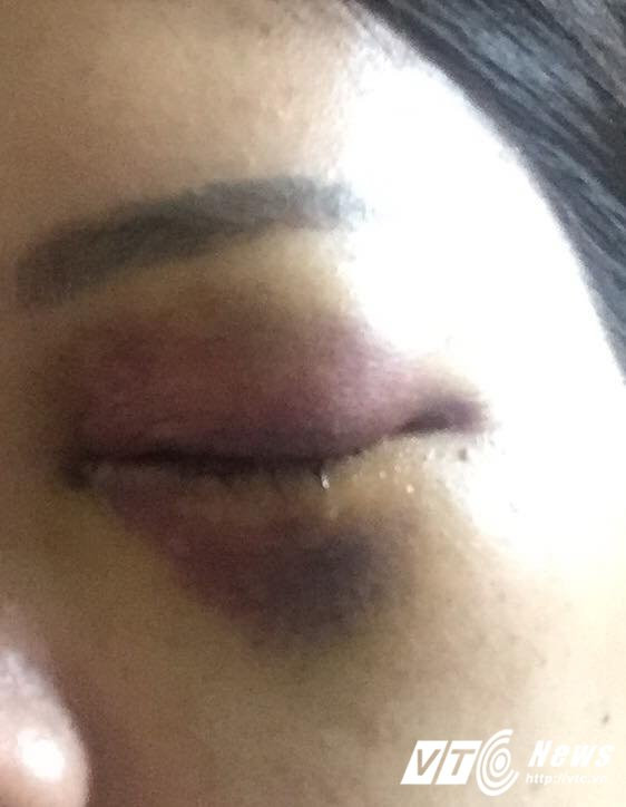 20258036_1427480157342111_2146277702904778724_n