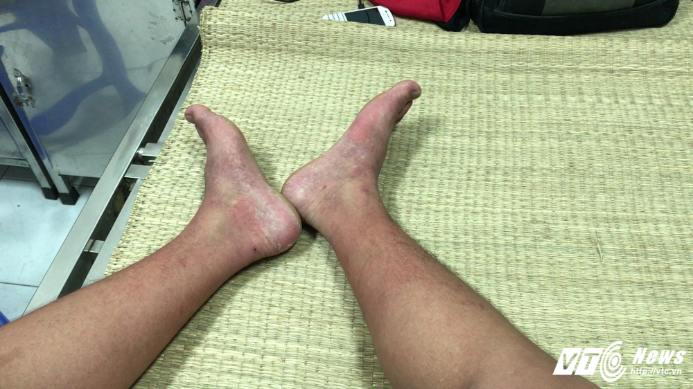 Snapshot - 3