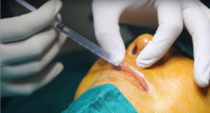 phau-thuat-tham-my-moi-nam-6