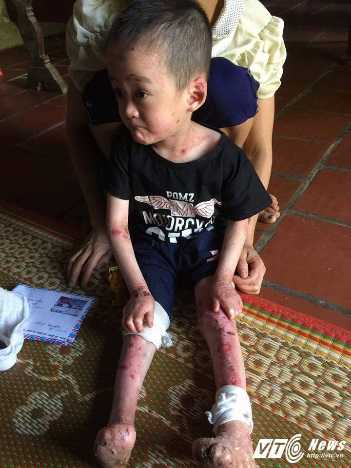 21230812_1883240471939898_4057254790750536042_n