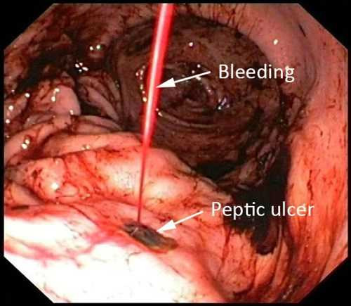 dadaybiviemloetvaphunmau