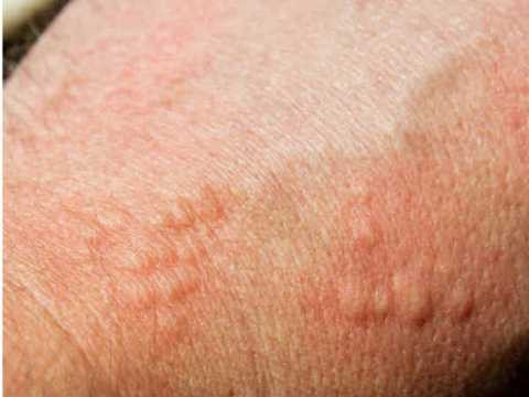 xtherearemanyfactorsthatcauseskincancer-28-1467105325.jpg.pagespeed.ic.a9AdRNOHFd