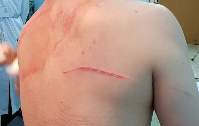 Vo cu chi 1 ty thue nguoi truy sat bac si Chiem Quoc Thai? hinh anh 1