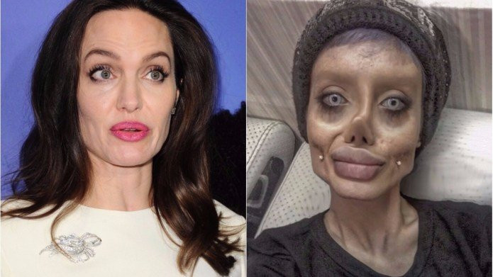After-50-Surgeries-Iran-Teen-Sahar-Tabar-Look-Like-Angelina-Jolie