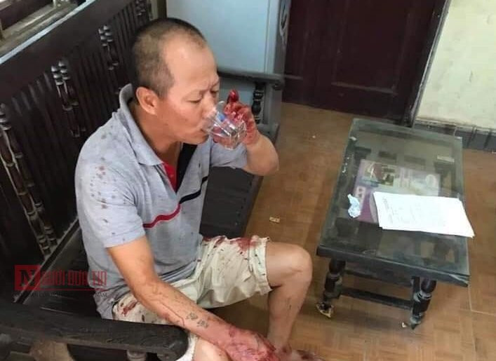 vu-tham-sat-anh-em-ruot-5-nguoi-thuong-vong 4