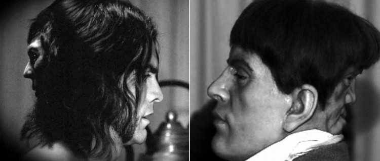 1476170488_nguoi-dan-ong-hai-mat-khien-the-gioi-khiep-so-anh-chup-thoi-diem-edward-con-song