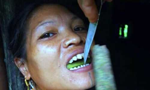 148168760163349-filing_teeth