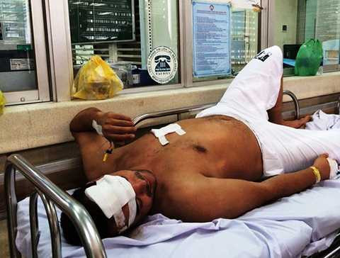 xong-vao-khu-chung-cu-dam-nguoi-cuop-tai-san (1)