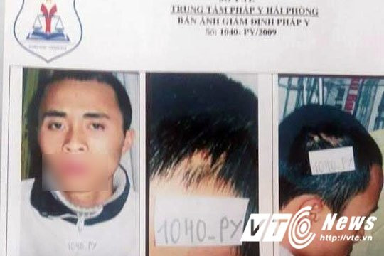 Hinh anh Ky an 8 nam o Hai Phong: Sau khi giam 51% suc khoe van trung tuyen nghia vu quan su