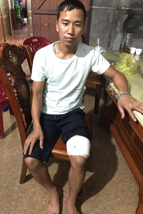 Hinh anh Dam chet 'dong nghiep' khi van chuyen than o Quang Ninh:Nghi can khai gi?