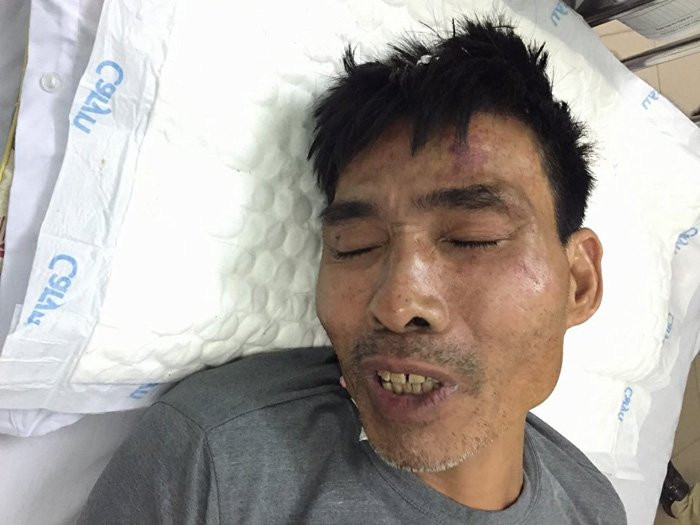 24099663_1319086131537136_29901926_n 4