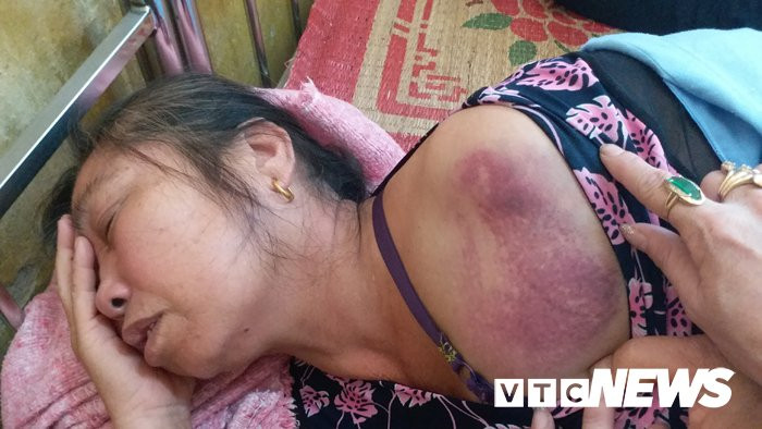 20181009_110738 (1) copy 7