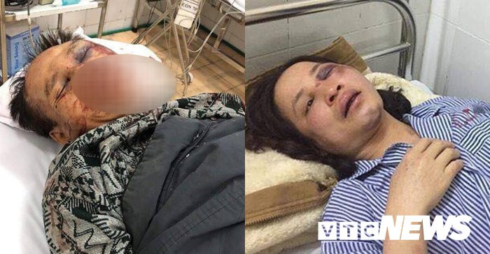 hai vo chong ong Hong bi danh 4