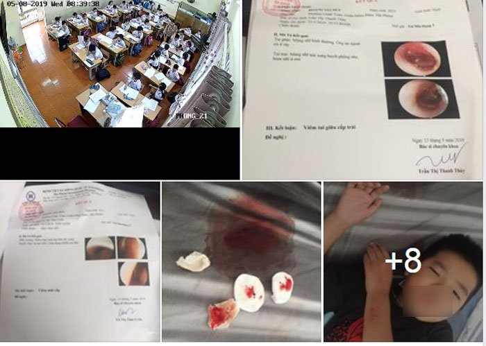 co giao tat lien tiep vao mat nhieu hoc sinh 3