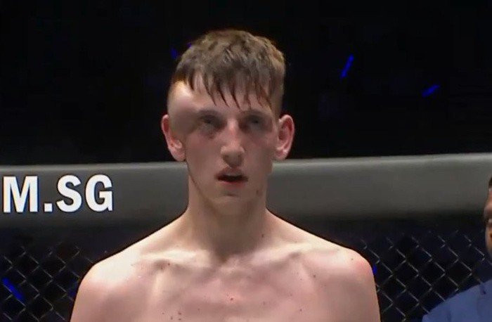 vo si chan thuong kinh di moc qua oi tren dau