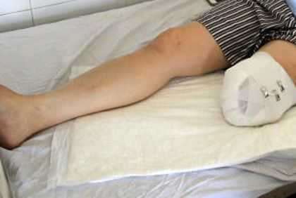 benh-nhan-1480089121