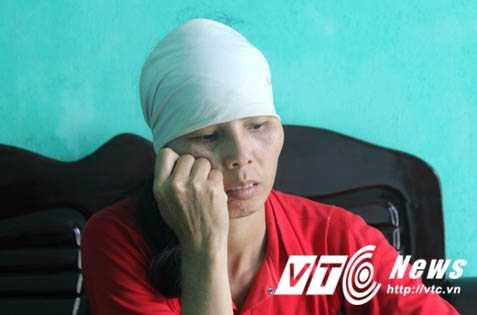 nguoi-dan-ba-song-sot-duoi-ban-tay-ac-quy-0