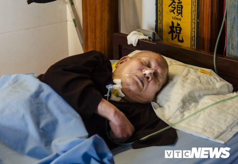 Canh-tay-bat-hoai-tai-Ha-Tinh (2)