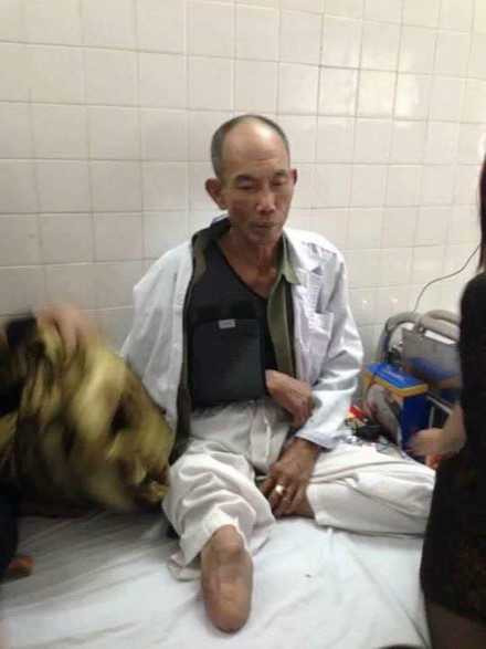 Công an, luật sư vào cuộc vụ cựu binh cụt chân bị đánh nhập viện ảnh 1