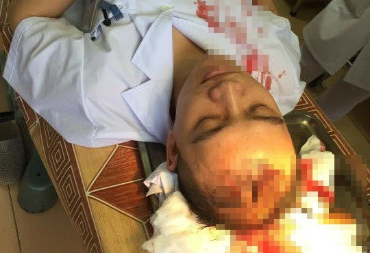 Hinh anh Con do hung han vao vien truy sat benh nhan, bac sy: Moi lo ve anh ninh benh vien 7