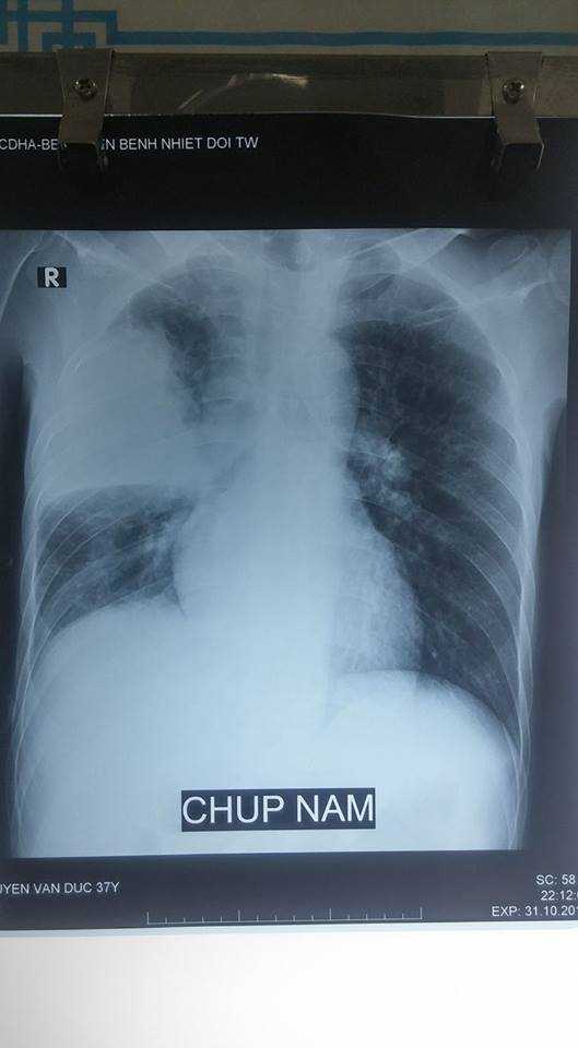 147816289720851-nghien-ruou-1