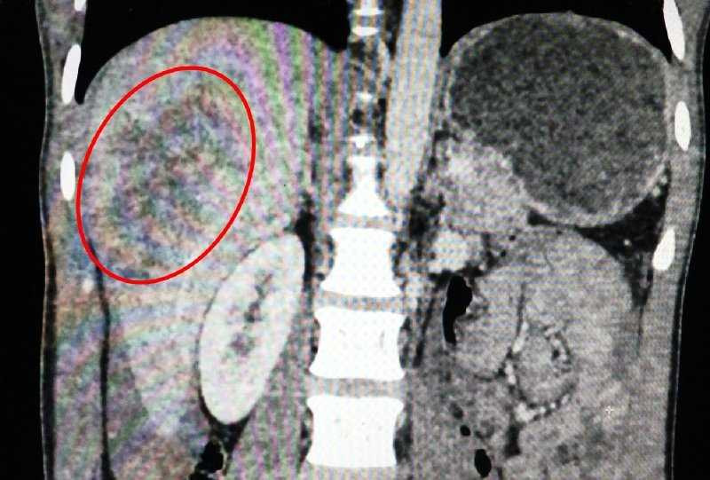 20161111213737-vo-gan