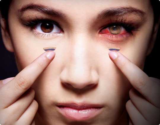 case001-contact-lens-1478857065725