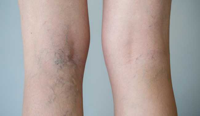 shutterstock-207272233-2-1478085080563-1478855618362