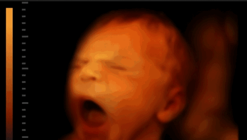 20150709-nhung-nang-luc-ky-la-cua-thai-nhi-nam-trong-bung-me-2