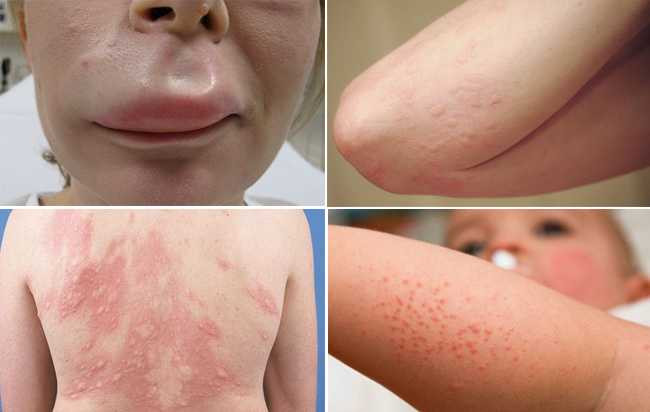 diung2-1477386873041