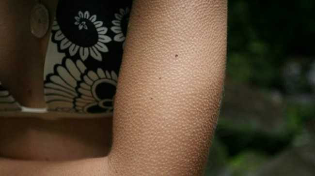 phan_ung_cua_co_the_6