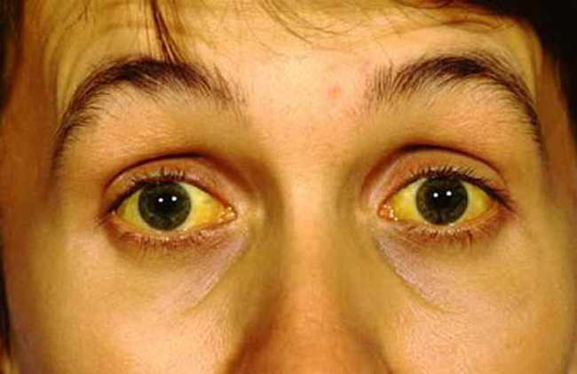 viemgan1-1478002560461