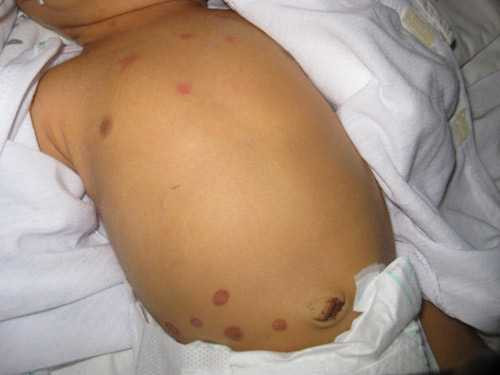 4-meo-dan-gian-chua-benh-khung-khiep-me-phai-tranh-xa-hinh-2