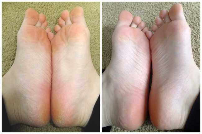 feet-pre-soak-horz-1473515358336