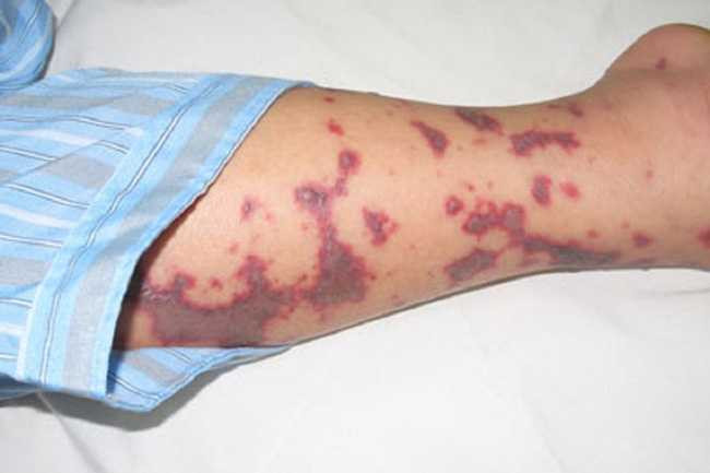 naomocau1-1480671783438