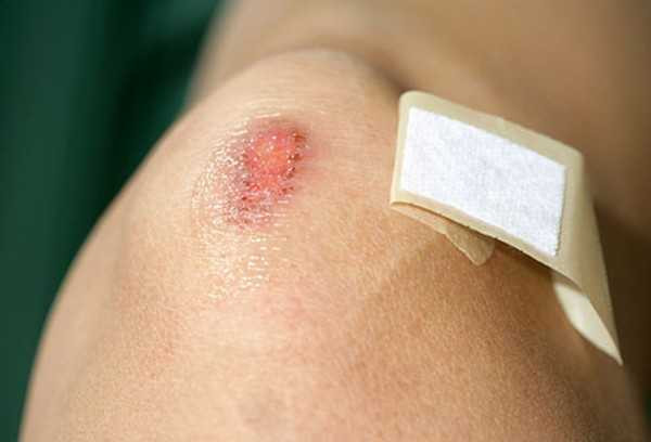 nguy-co-bi-hoai-tu-chi-vi-nhung-bat-can-khong-ai-ngo (1)