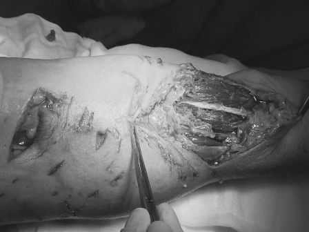 cho-can-1-1482852471087