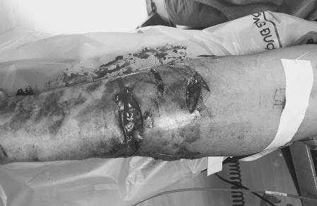 cho-can-2-1482852471090