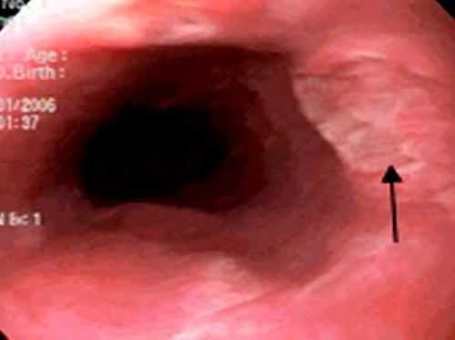 tri-mun-4589-1483497630