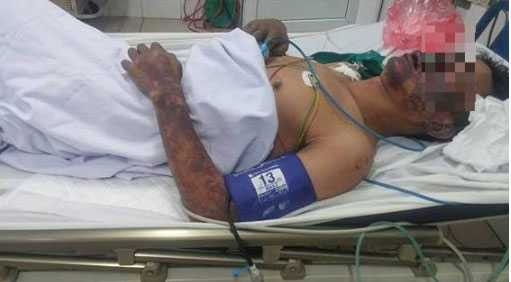 ban-hoai-tu-1483672217814