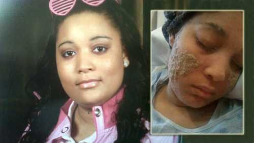 benh-la-3393-1483713636