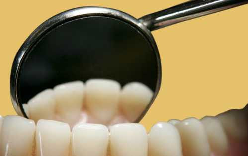 teeth-6592-1484102413