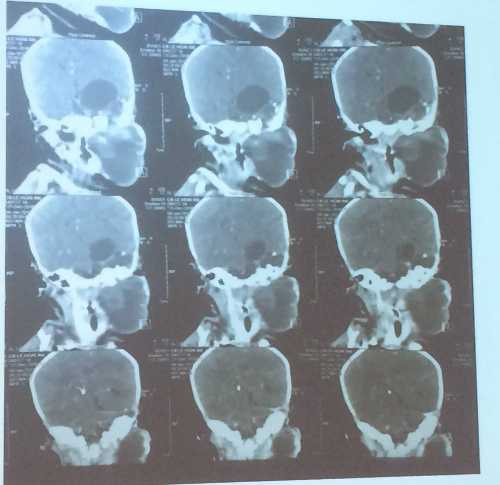 IMG-6422-JPG-4728-1484897916