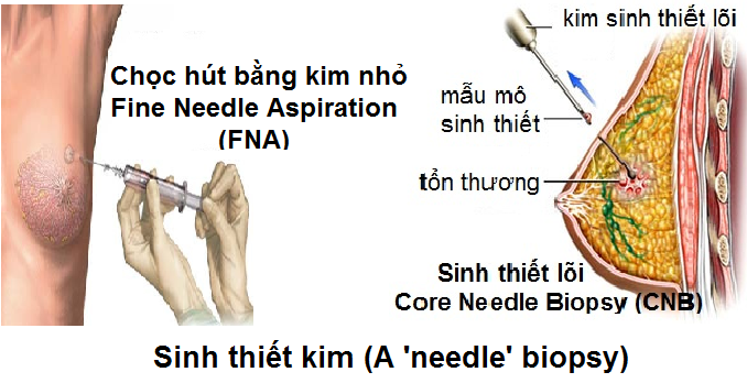 6-xet-nghiem-giup-phat-hien-som-ung-thu-2