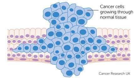 cancer-cells-growing-through-normal-tissue-1486349855