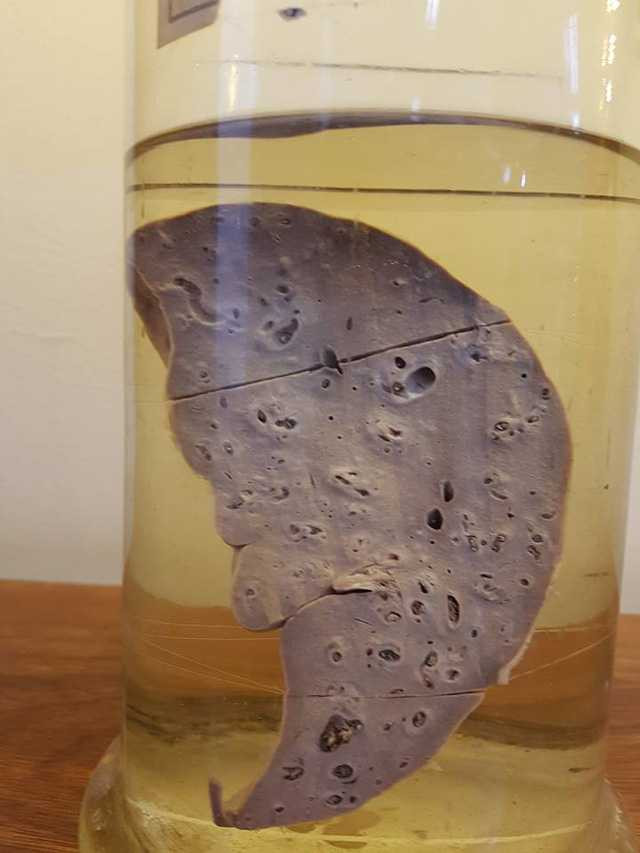 ky-sinh-trung-6-1486572762132