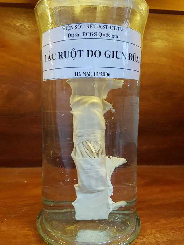 ky-sinh-trung-9-1486572762137