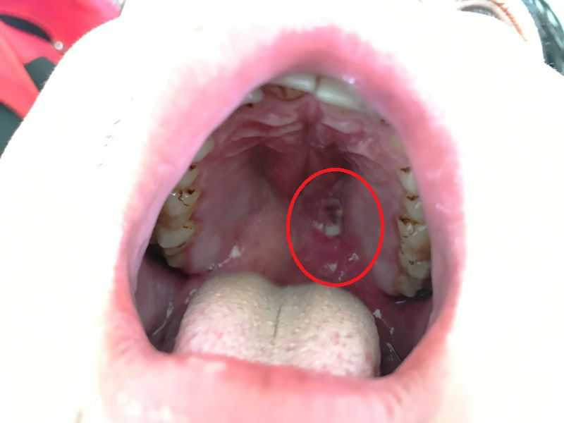 20170217114552-thung-vom-hong-khi-dung-mieng-thoi-vao-nong-sung