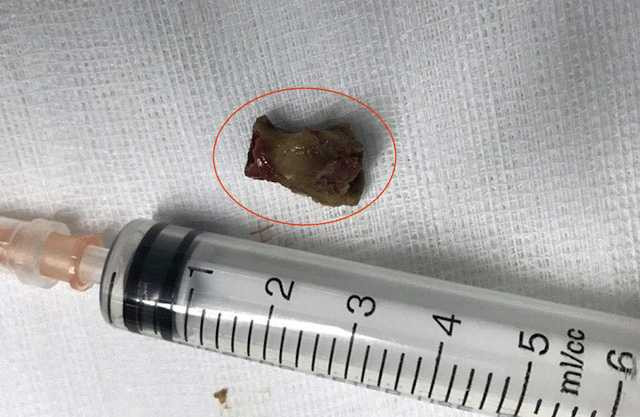 16708364-1321803421219191-5705489238104395213-n-1487872571011