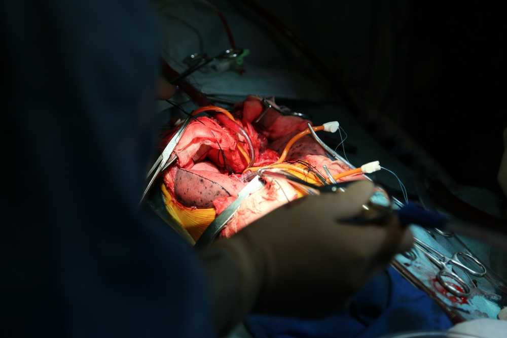 Nhung-hinh-anh-dac-biet-ve-ca-ghep-phoi-thanh-cong-dau-tien-2